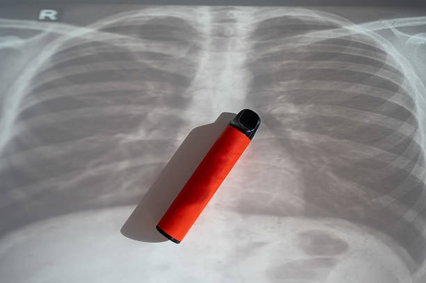 How Disposable Vapes Affect Lung Health (Global Study Review)