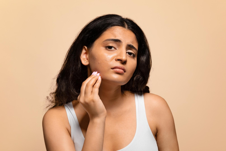 A Complete Guide for Oily Skin Care