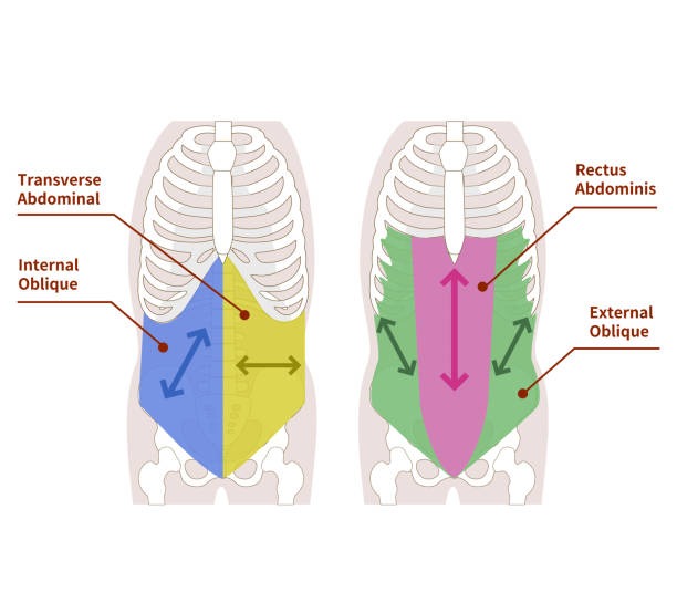 Abdominal discomfort and cramping are linked to progressive luminal narrowing from abnormal tissue growth