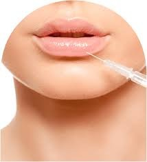 Buy Dermal Fillers Online USA: A Complete Guide (2025 Tutorial & Industry Update)