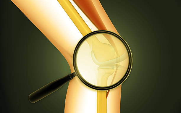 Factors That Affect Healing After Meniscus Repair