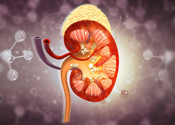 First 5 Signs of a Kidney Stone