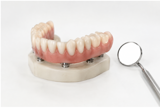 Full-Arch Tooth Replacement in Oklahoma City, OK: What to Know Before Treatment