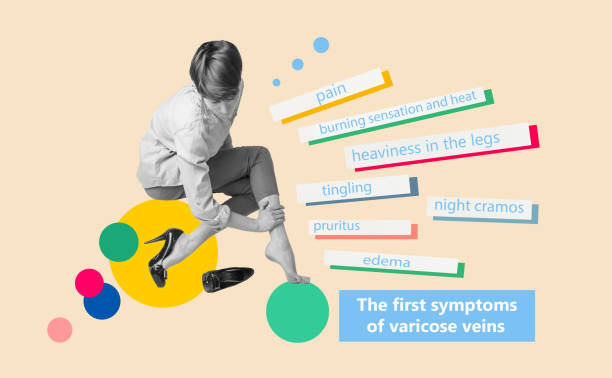 How Likely You Are to Get Varicose Veins If Your Parents Had Them