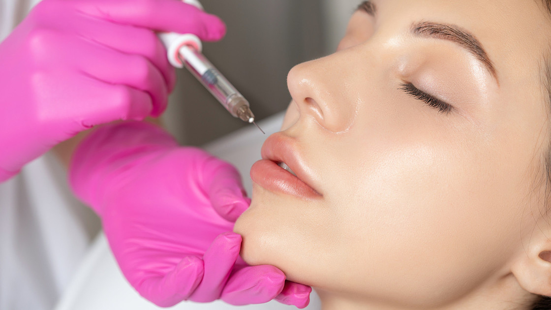 How Long Do Dermal Fillers Last in Dubai?