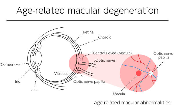How Nutrients Help Slow Age-Related Macular Degeneration