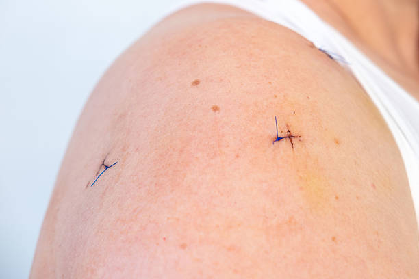 How Physical Therapy Speeds Up Post-Surgery Recovery