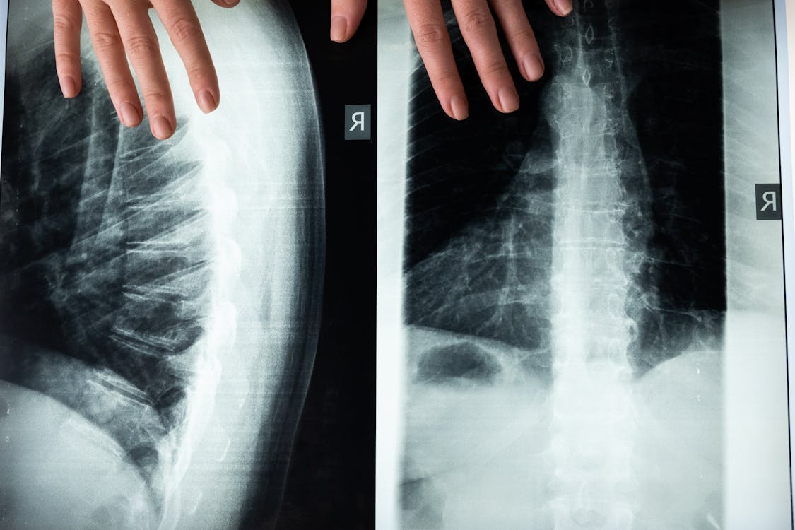 How to Document Your Injuries to Strengthen Your Claim