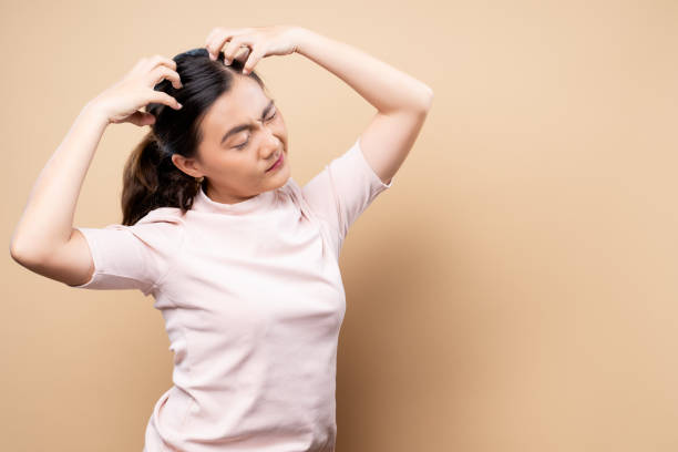How to Get Rid of Itchy and Flaky Scalp Effectively