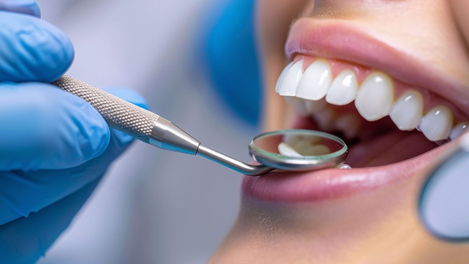How to Prevent Common Dental Emergencies Through Proactive Care