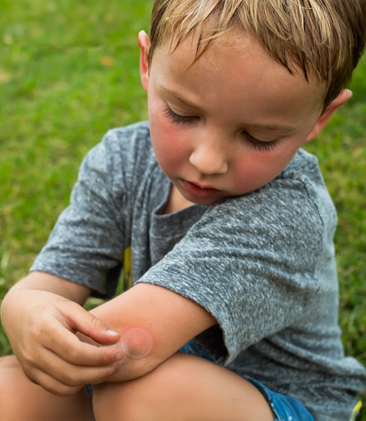 Itchy Bug Bites Ruined My Workdays Until I Found Patches