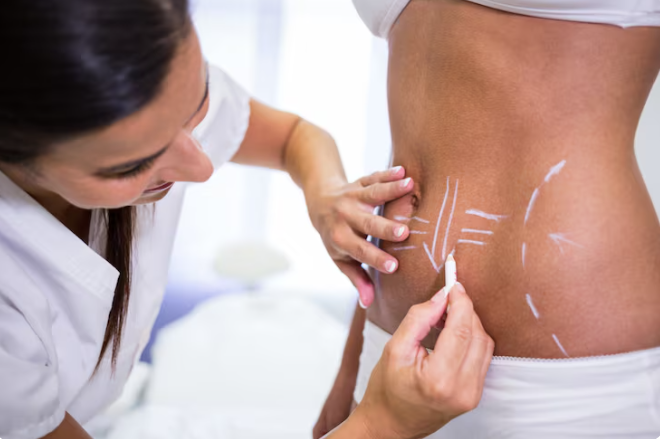 LipoDoc: A Chicago Practice Focused on Liposuction and Body Contouring