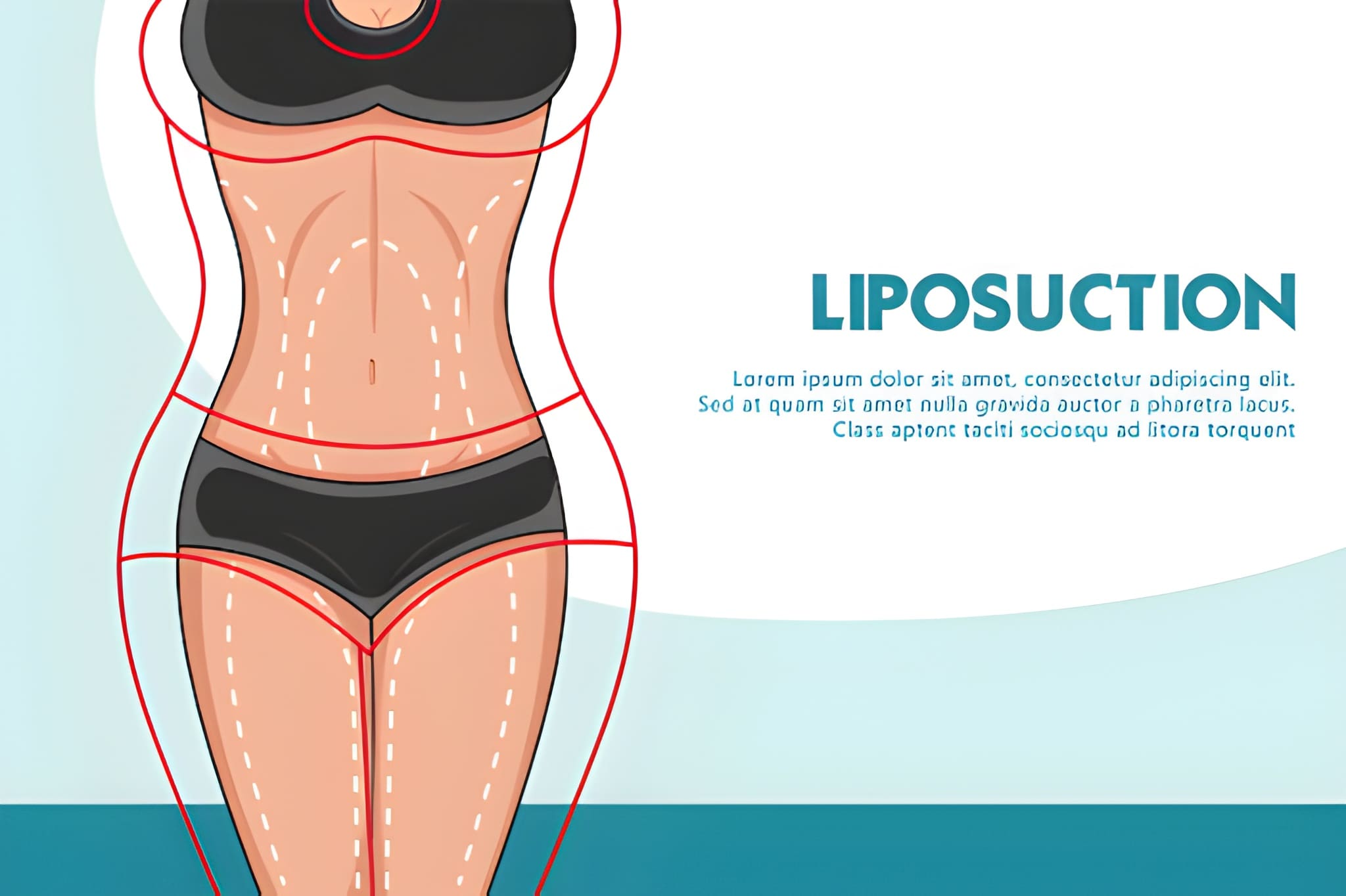 Liposuction Near Me: Advanced Fat Removal Surgery for Precision Body Contouring