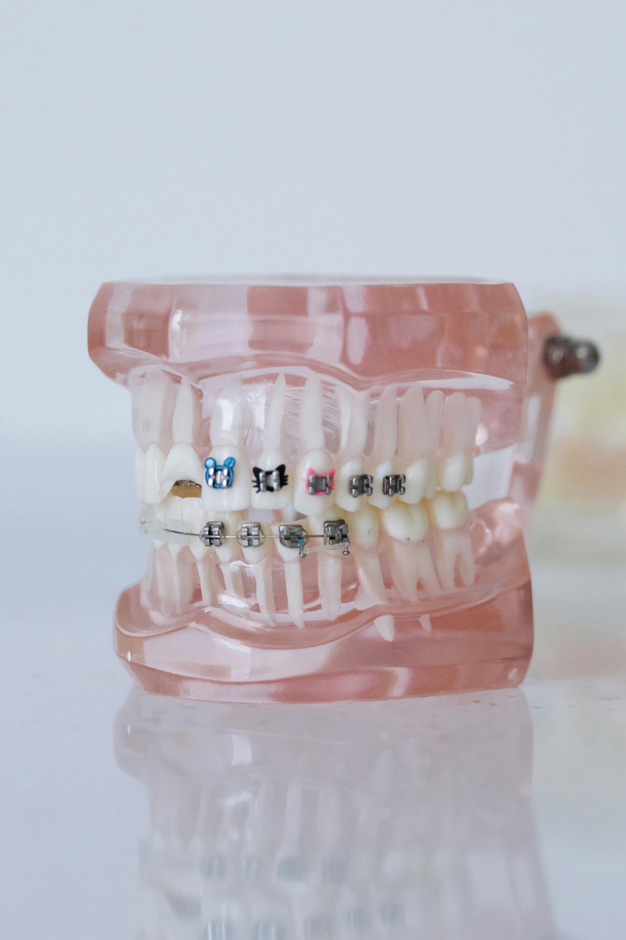 Managing Orthodontic Issues at Home