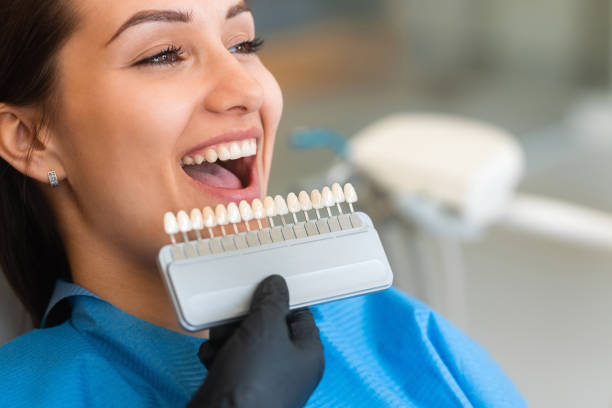 Seamlessly Beautiful: How Technology Perfects Dental Veneers for Your Smile