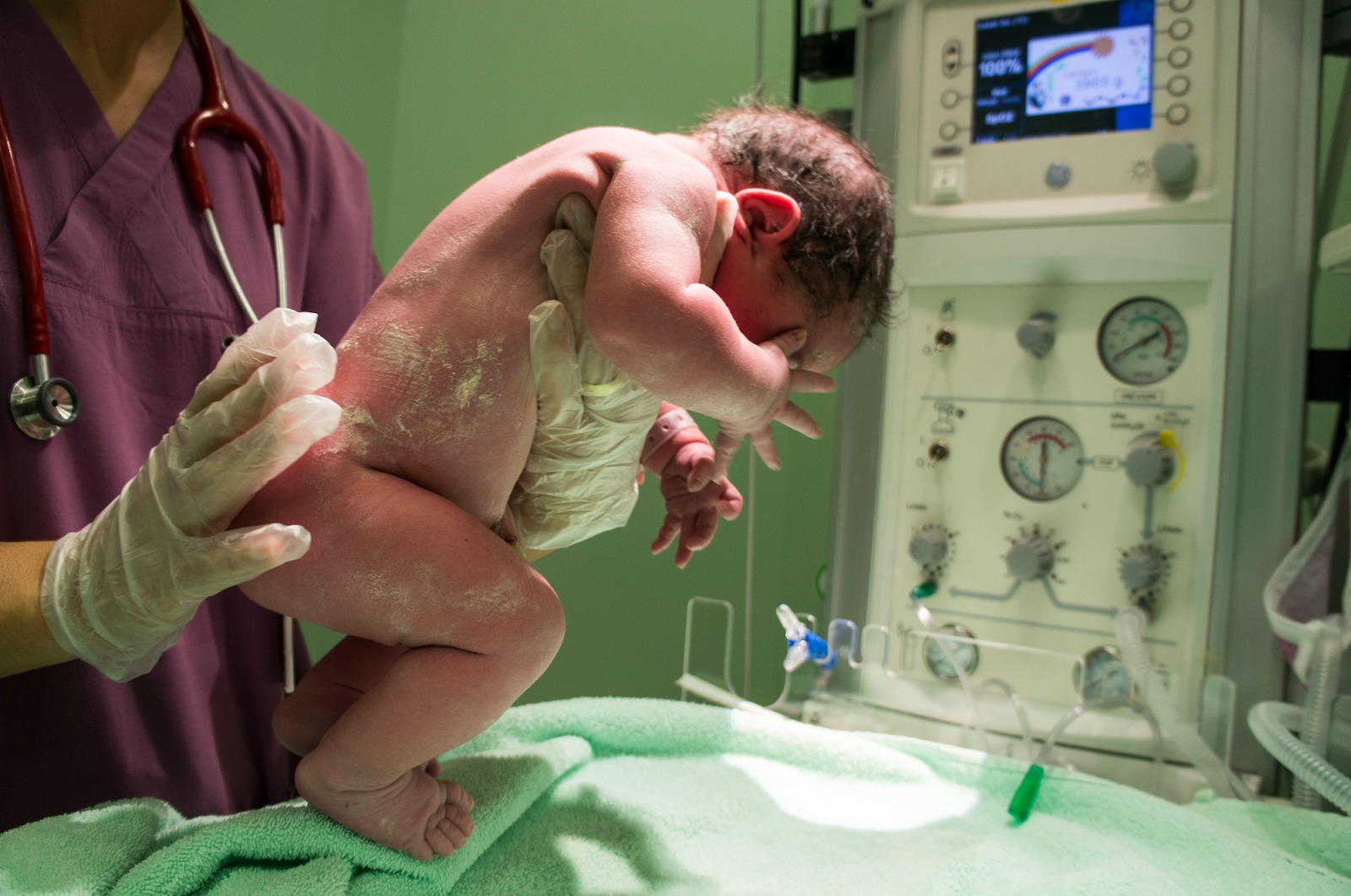 Understanding Birth Injuries Caused by Medical Negligence