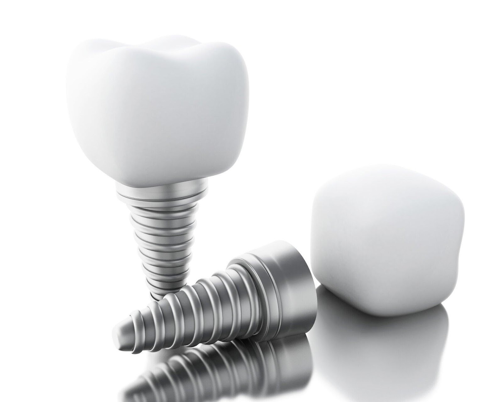 Understanding Dental Implants: A Comprehensive Guide
