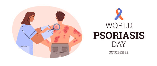 Understanding Psoriasis Flare-Ups and How to Manage Them Effectively