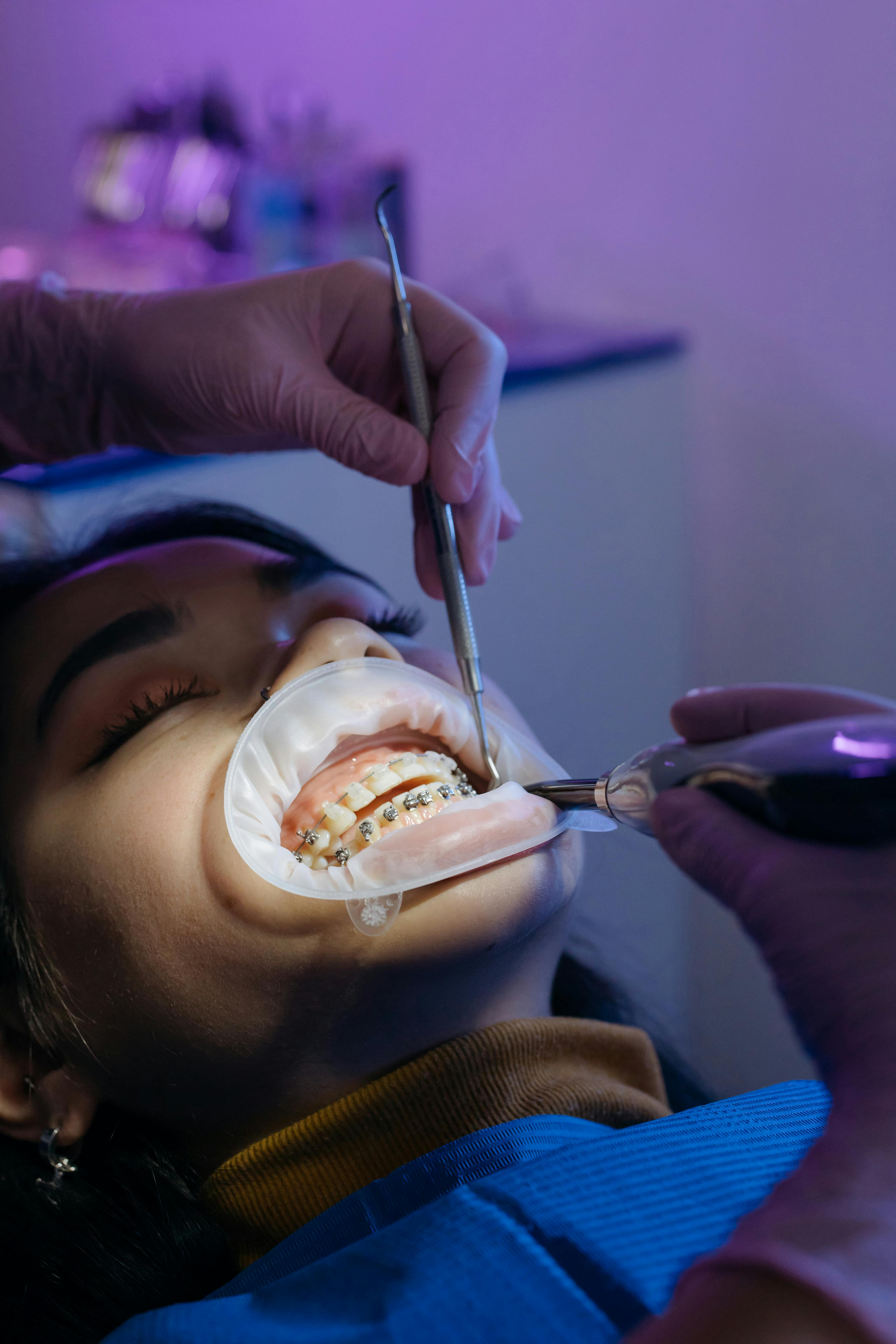 What to Expect from Root Canal Treatments
